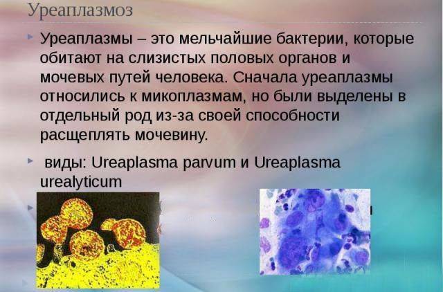 Умови при яких уреаплазма викликає цистит та лікування захворювання