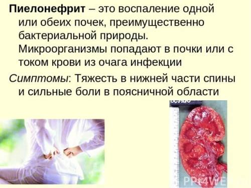 Урологічні антибіотики при циститі і пієлонефриті