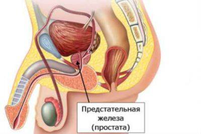 Ускладнення циститу наслідки для жінок Ускладнення циститу наслідки для жінок