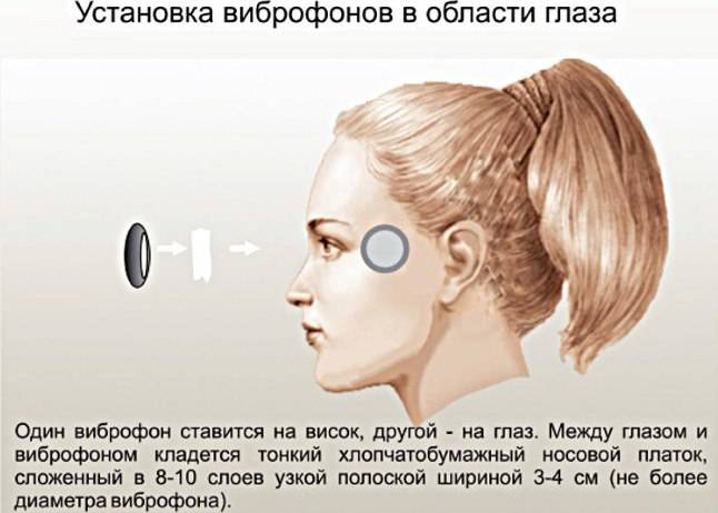 Вітафон при циститі – Без циститу