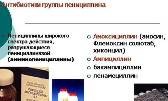 Вилікувати хронічний цистит травами – Цистит