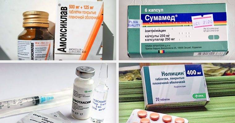 Як довго приймати антибіотики при циститі