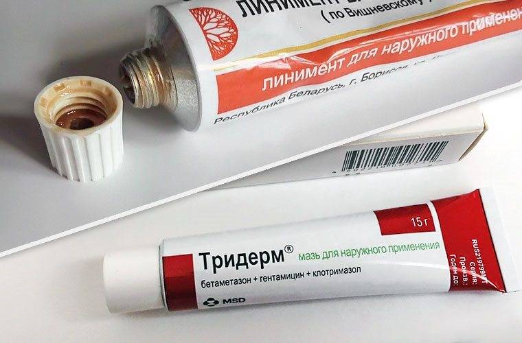 Як використовувати лікувальні тампони при циститі