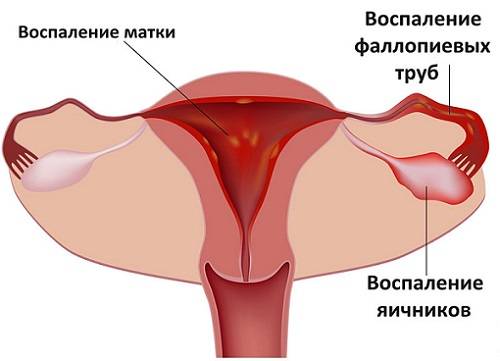 Яка взаємозв’язок уреаплазми і циститу